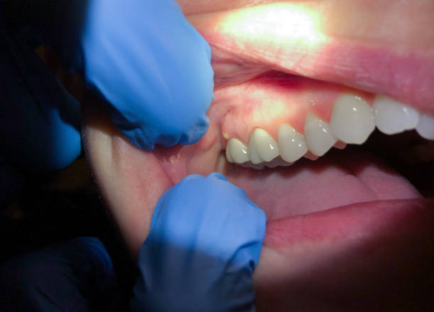 Best Emergency Treatment for Toothache in Murphy, TX