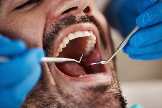 Best Emergency Treatment for Toothache in Murphy, TX